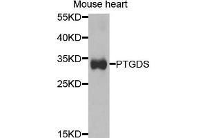 Western blot analysis of extracts of mouse heart, using PTGDS antibody. (PTGDS 抗体)