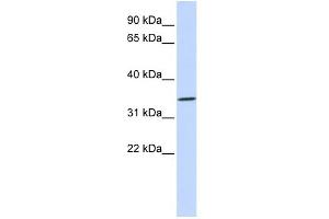WB Suggested Anti-RHCE Antibody Titration:  0. (RHCE 抗体  (N-Term))