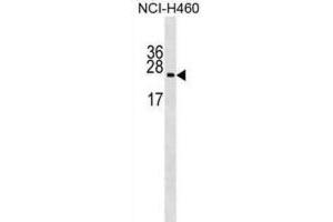 Western Blotting (WB) image for anti-Ribosomal Protein L10a (RPL10A) antibody (ABIN2999207) (RPL10A 抗体)