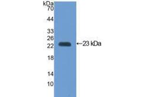 Western blot analysis of recombinant Mouse VCAM1. (VCAM1 抗体  (AA 116-309))