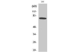 Western Blotting (WB) image for anti-Bruton Agammaglobulinemia tyrosine Kinase (BTK) (Ser189) antibody (ABIN3183568) (BTK 抗体  (Ser189))