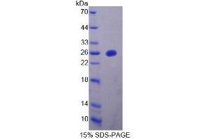 SDS-PAGE analysis of Mouse MTUS1 Protein. (MTUS1 蛋白)