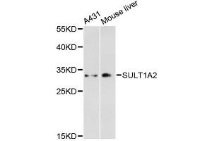 Western blot analysis of extracts of various cell lines, using SULT1A2 antibody. (SULT1A2 抗体)