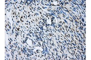 Immunohistochemical staining of paraffin-embedded liver tissue using anti-GBE1 mouse monoclonal antibody. (GBE1 抗体)
