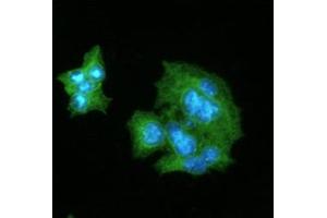 ICC/IF analysis of CRP in HepG2 cells line, stained with DAPI (Blue) for nucleus staining and monoclonal anti-human CRP antibody (1:100) with goat anti-mouse IgG-Alexa fluor 488 conjugate (Green). (CRP 抗体)