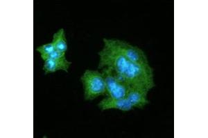 ICC/IF analysis of CRP in HepG2 cells line, stained with DAPI (Blue) for nucleus staining and monoclonal anti-human CRP antibody (1:100) with goat anti-mouse IgG-Alexa fluor 488 conjugate (Green). (CRP 抗体  (AA 19-224))