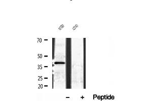 Western blot analysis of extracts of A2780 cells, using NDE1 antibody. (NDE1 抗体  (N-Term))