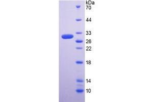 SDS-PAGE analysis of Human RGN Protein. (Regucalcin Protein (RGN))