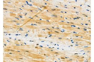 ABIN6263136 and ABIN6273134 at 1/100 staining Mouse heart tissue by IHC-P.