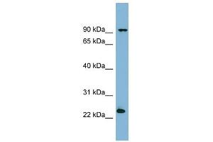 VPS29 antibody used at 1 ug/ml to detect target protein. (VPS29 抗体)