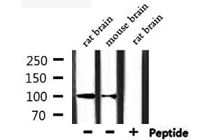 Western blot analysis of extracts from rat brain, mouse brain, using CHSY3 Antibody. (CHSY3 抗体  (N-Term))
