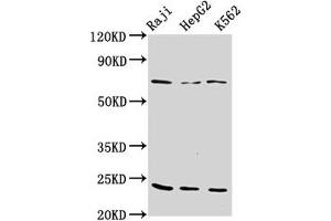 Western Blot Positive WB detected in: Raji whole cell lysate, HepG2 whole cell lysate, K562 whole cell lysate All lanes: PSMB9 antibody at 10 μg/mL Secondary Goat polyclonal to rabbit IgG at 1/50000 dilution Predicted band size: 24, 23 kDa Observed band size: 24 kDa (PSMB9 抗体  (AA 21-219))