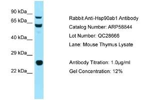 Western Blotting (WB) image for anti-Heat Shock Protein 90kDa alpha (Cytosolic), Class B Member 1 (HSP90AB1) (N-Term) antibody (ABIN2787849)