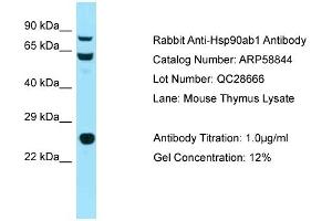 Western Blotting (WB) image for anti-Heat Shock Protein 90kDa alpha (Cytosolic), Class B Member 1 (HSP90AB1) (N-Term) antibody (ABIN2787849) (HSP90AB1 抗体  (N-Term))