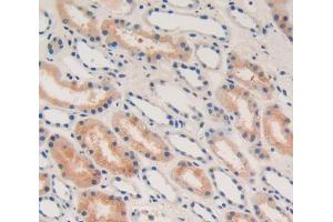 Used in DAB staining on fromalin fixed paraffin- embedded Kidney tissue (IFNA 抗体  (AA 24-189))