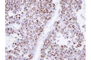 Immunohistochemistry (IHC) image for anti-Enoyl CoA Hydratase, Short Chain, 1, Mitochondrial (ECHS1) antibody (ABIN2855654)