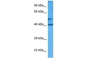 Host:  Mouse  Target Name:  CKM  Sample Tissue:  Mouse Small Intestine  Antibody Dilution:  1ug/ml (CKM 抗体  (Middle Region))