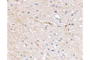 Immunohistochemical staining of human brain tissue using FBXL20 polyclonal antibody  at 2. (FBXL20 抗体  (N-Term))