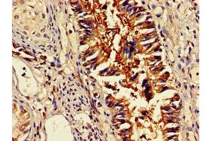IHC image of ABIN7159465 diluted at 1:400 and staining in paraffin-embedded human lung tissue performed on a Leica BondTM system. (OMA1 抗体  (AA 22-194))