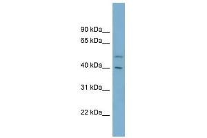 B4GALT2 antibody used at 1 ug/ml to detect target protein. (B4GALT2 抗体  (Middle Region))