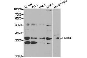 Western Blotting (WB) image for anti-Peroxiredoxin 4 (PRDX4) antibody (ABIN1874258) (Peroxiredoxin 4 抗体)