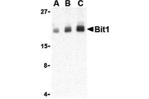 Western Blotting (WB) image for anti-Peptidyl-tRNA Hydrolase 2 (PTRH2) (Middle Region) antibody (ABIN1030890) (PTRH2 抗体  (Middle Region))