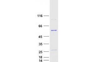 Western Blotting (WB) image for Septin 6 (SEPT6) (Transcript Variant 1) protein (Myc-DYKDDDDK Tag) (ABIN2731692)