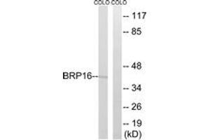 Western blot analysis of extracts from COLO cells, using BRP16 Antibody. (FAM203B 抗体  (AA 251-300))