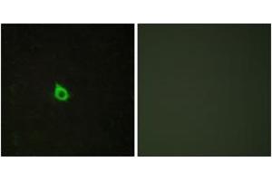 Immunofluorescence analysis of HepG2 cells, using RECK Antibody. (RECK 抗体  (AA 21-70))