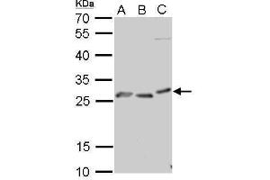WB Image PRP antibody detects PRNP protein by Western blot analysis. (PRNP 抗体)