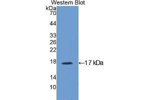 Western Blotting (WB) image for anti-Insulin-Like Growth Factor Binding Protein 3 (IGFBP3) (AA 137-274) antibody (ABIN1172101)