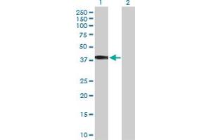 Western Blot analysis of HSD11B2 expression in transfected 293T cell line by HSD11B2 MaxPab polyclonal antibody. (HSD11B2 抗体  (AA 1-405))