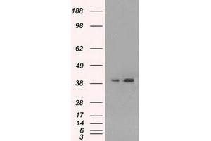 HEK293T cells were transfected with the pCMV6-ENTRY control (Left lane) or pCMV6-ENTRY MAPK1 (Right lane) cDNA for 48 hrs and lysed. (ERK2 抗体)