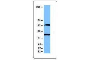 Western Blotting (WB) image for anti-Caspase 8 (CASP8) antibody (ABIN2666061) (Caspase 8 抗体)