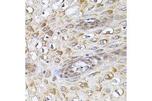 Immunohistochemistry of paraffin-embedded human esophagus using CETP antibody (ABIN5970634) (40x lens). (CETP 抗体)