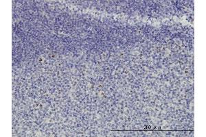 Immunoperoxidase of monoclonal antibody to HSPC111 on formalin-fixed paraffin-embedded human tonsil. (NOP16 抗体  (AA 1-178))