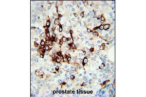 Vimentin Antibody (Center) (ABIN389213 and ABIN2839368) immunohistochemistry analysis in formalin fixed and paraffin embedded human prostate tissue followed by peroxidase conjugation of the secondary antibody and DAB staining.