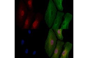 ABIN6257072 and ABIN6273592 staining  cells by IF/ICC.