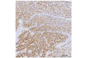 anti-Protein Phosphatase 1, Regulatory (Inhibitor) Subunit 15A (PPP1R15A) (AA 574-602) antibody