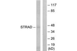 Western blot analysis of extracts from HepG2 cells, using STRAD Antibody. (STRADA 抗体  (AA 11-60))