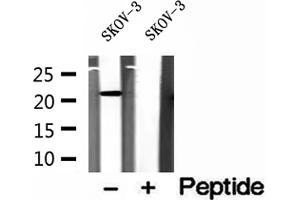 Western blot analysis of extracts of SKOV-3 cells, using ICT1 antibody.