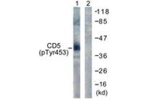Western blot analysis of extracts from 293 cells treated with PMA 125ng/ml 30' , using CD5 (Phospho-Tyr453) Antibody. (CD5 抗体  (pTyr453))