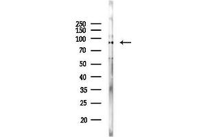 anti-Phosphoinositide 3 Kinase, p85 alpha/gamma (PI3K p85a/g) antibody