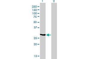 Western Blot analysis of NQO1 expression in transfected 293T cell line by NQO1 monoclonal antibody (M01), clone 1E3-A6. (NQO1 抗体  (AA 1-274))