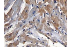 IHC-P analysis of Mouse Cardiac Muscle Tissue, with DAB staining. (SFRP1 抗体  (AA 32-314))