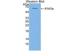 Western blot analysis of the recombinant protein. (TGFBR3 抗体  (AA 469-724))