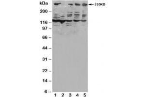 Western blot testing of ATM antibody and Lane 1:  HeLa;  2: SMMC-7721;  3: U87;  4: A549;  5: MCF-7 (ATM 抗体  (N-Term))