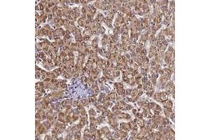 Immunohistochemical staining of human liver with LRRIQ1 polyclonal antibody  shows strong cytoplasmic positivity in hepatocytes. (LRRIQ1 抗体)