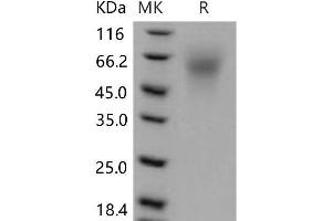 Western Blotting (WB) image for LY6/PLAUR Domain Containing 3 (LYPD3) (Active) protein (His tag) (ABIN7320237)