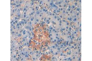 Immunohistochemistry (IHC) image for anti-Protein tyrosine Phosphatase, Receptor Type, N Polypeptide 2 (PTPRN2) (AA 839-1015) antibody (ABIN5014206)